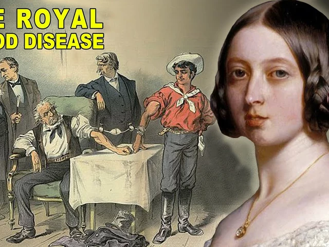 The History of Hemophilia: From Royal Disease to Modern Management
